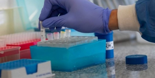 Covid-19: investigación para estimar el riesgo de transmisión