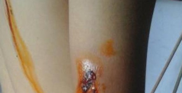 Cinco heridos en otro operativo policial en Los Cortaderos