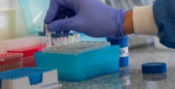 Covid-19: investigación para estimar el riesgo de transmisión